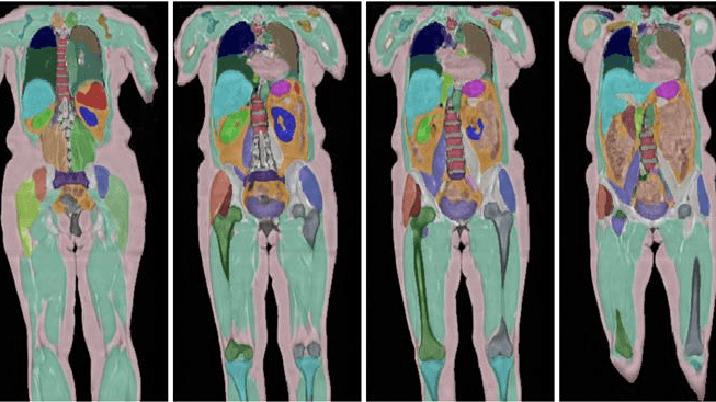 Biggest human imaging study scans 100,000th person