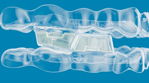 Align Technology Announces Invisalign® System With Mandibular Advancement Featuring Occlusal Blocks for Class II Skeletal and Dental Correction