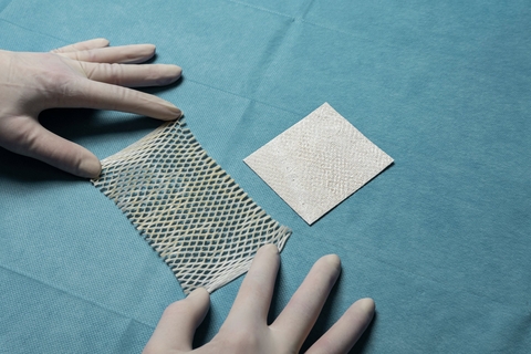 Cigna Adds Kerecis Intact Fish-Skin Grafts to Coverage Policy