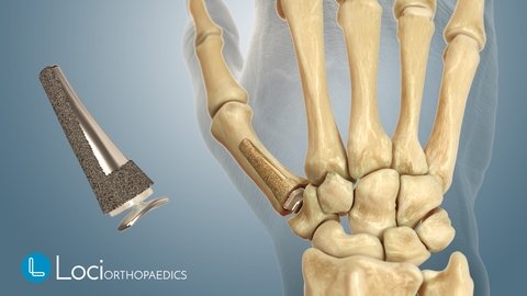 Attendance at the 2025 IFSSH and IFSHT Triennial Global Hand Care Congress