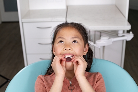 Invisalign® Palatal Expander System by Align Technology Now Available in India for Skeletal and Dental Expansion in Growing Patients
