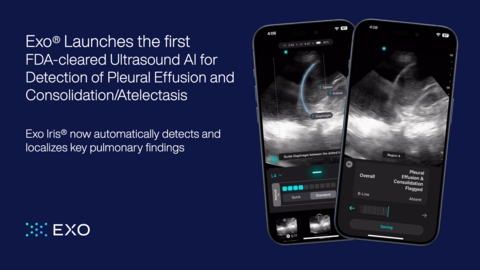 Exo Launches a New Era in Disease Diagnosis with the First FDA-cleared Ultrasound AI for Detection of Pleural Effusion and Consolidation/Atelectasis