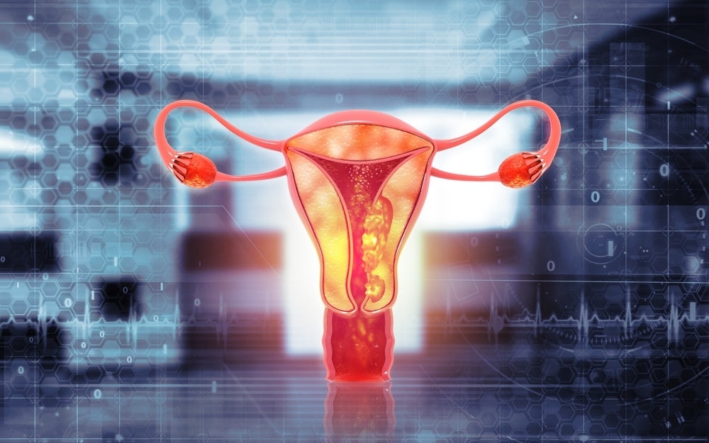 ASCO 2025: GSK's Jemperli fails to show OS benefit in 1L advanced ovarian cancer