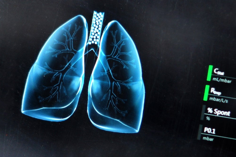 ASCO 2025: DeLLphi-304 helps Amgen to pave the way for BiTEs in solid cancers