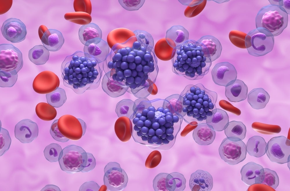 ASCO25: MSD's ADC candidate achieves 56.3% ORR in lymphoma trial