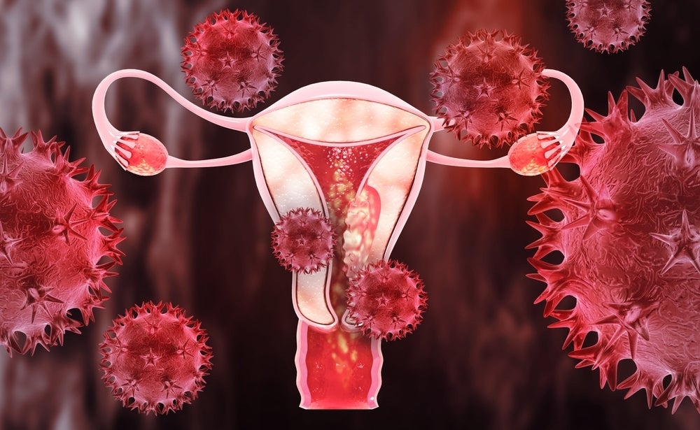 NHS approves long-term daily pill for endometriosis in England