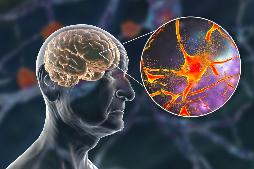 Semaglutide improves brain-related injury patients' outcomes