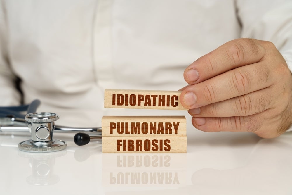Biomarkers may address unmet needs of idiopathic pulmonary fibrosis treatment