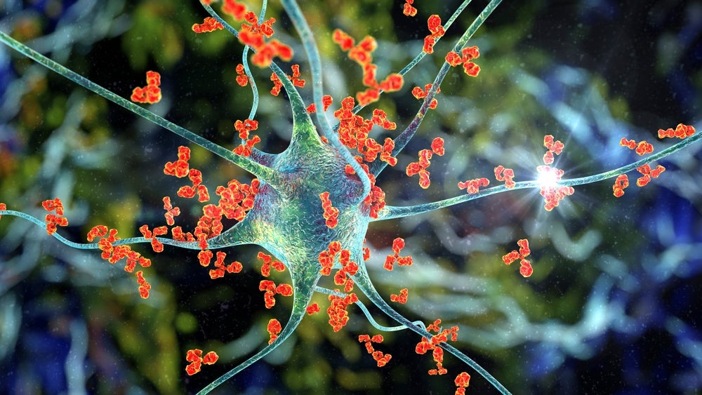 AAN 2025: Sanofi's tolebrutinib likely to be first BTK inhibitor for the treatment of MS
