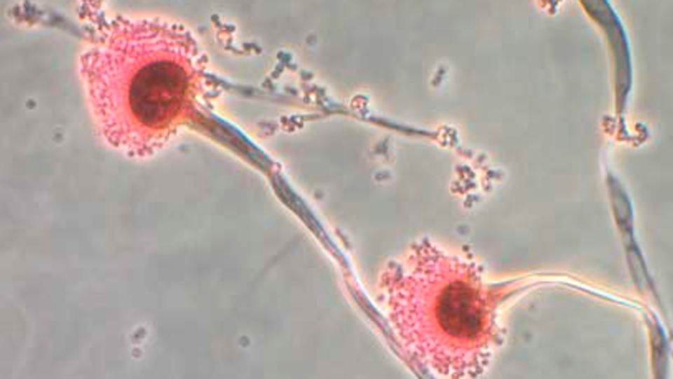 A fungi that can ‘eat you from the inside out' could spread as the world heats up