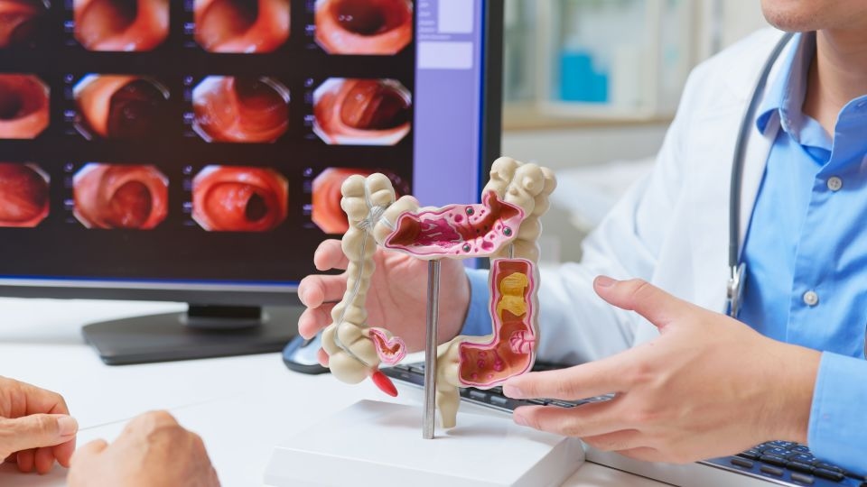 As more young people get screened, more colon cancer is being found early. Here's how to lower your risk