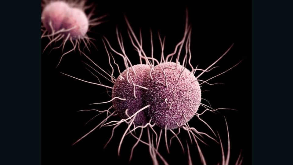 New antibiotic is effective against gonorrhea, could be first new treatment since 1990s, study says