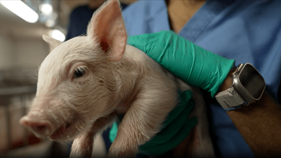 What are your questions about the future of organ transplants?