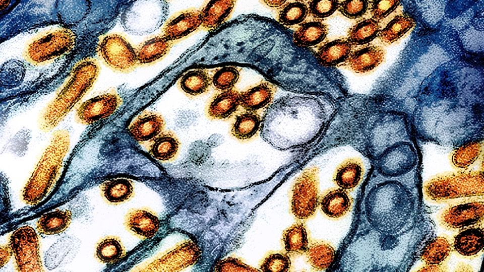 The US hasn't seen a human bird flu case in 3 months. Experts are wondering why