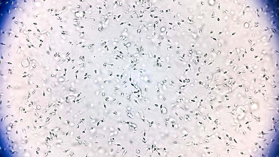 Sperm donor with rare genetic mutation fathered 67 children. Ten now have cancer, prompting calls for reform