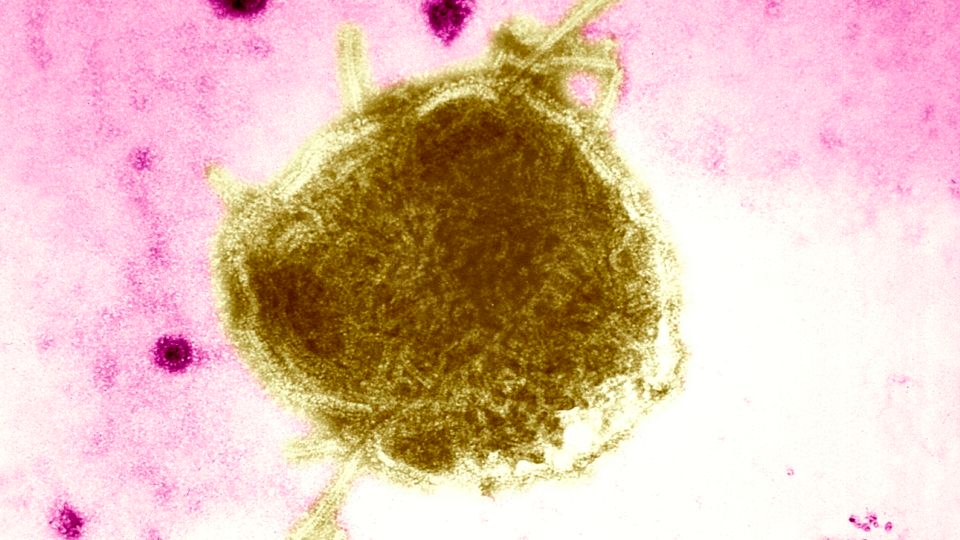 West Texas measles outbreak doubles to 48 cases