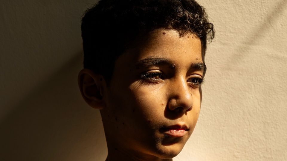 Portrait of a wounded Palestinian boy wins Press Photo of the Year