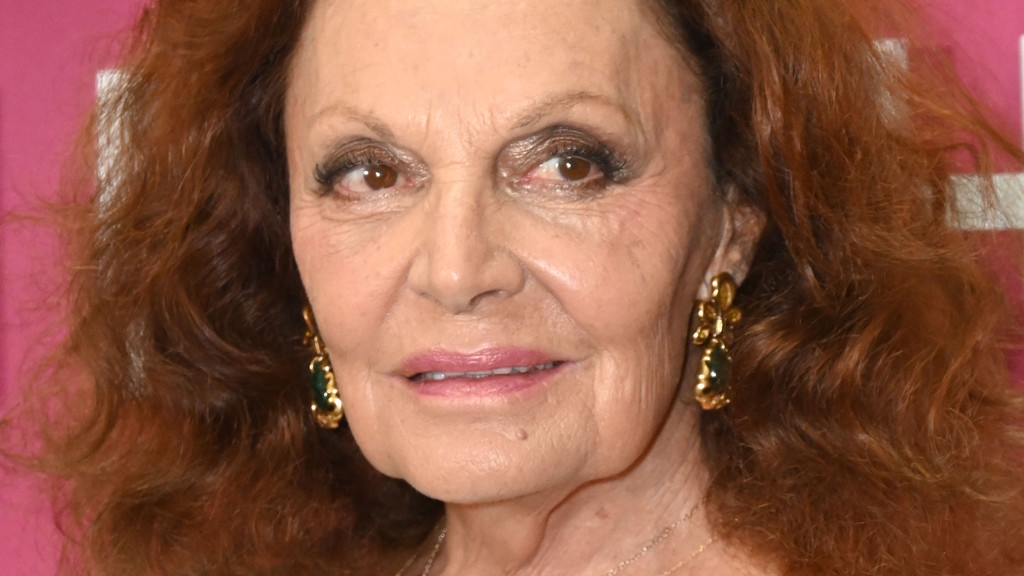 Diane Von Furstenberg shares news of nasty fall