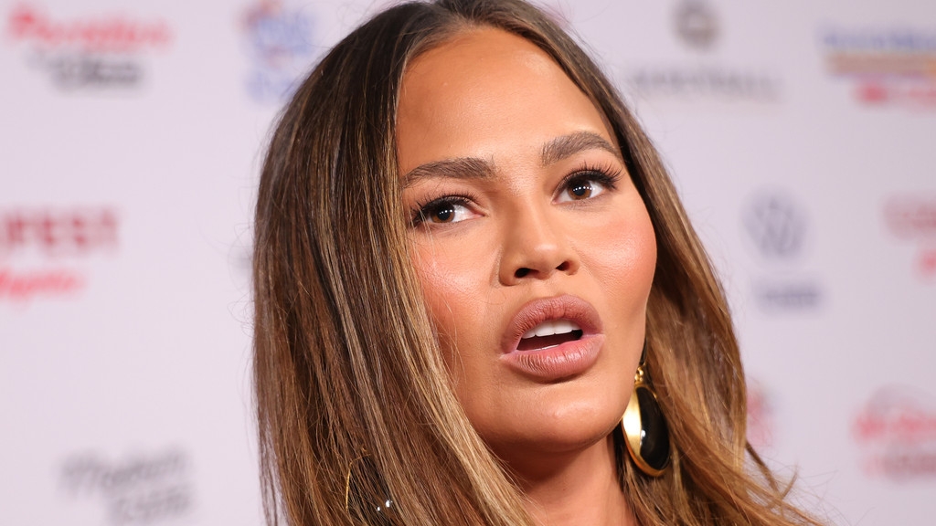 Chrissy Teigen undergoes 'hairline-lowering procedure'