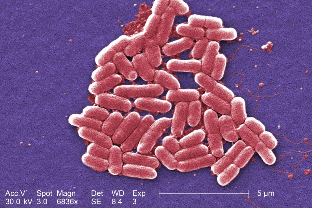 Silence on E. Coli outbreak highlights how Trump's changes undermine food safety