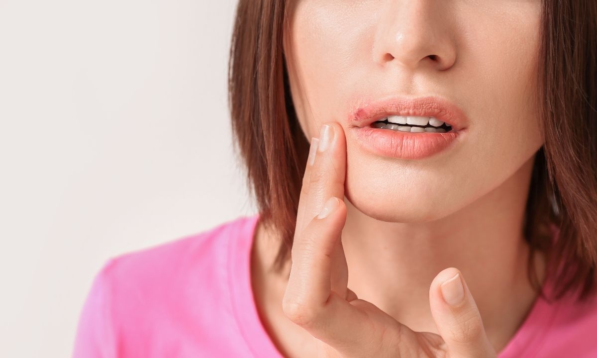 Study Links Herpes Virus To Alzheimer's Risk, But Experts Urge Caution