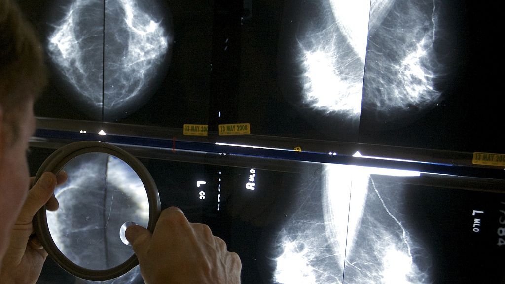 Breast cancer death rates across Europe are expected to drop in 2025. How do countries compare?