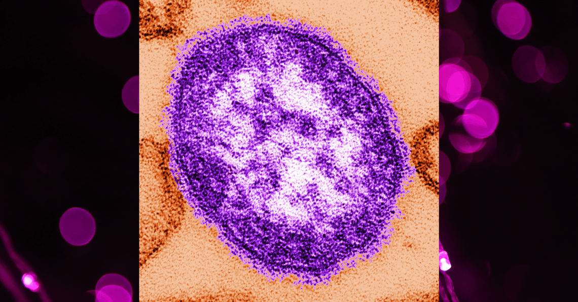 A second child with measles has died in Texas as the outbreak continues to spread