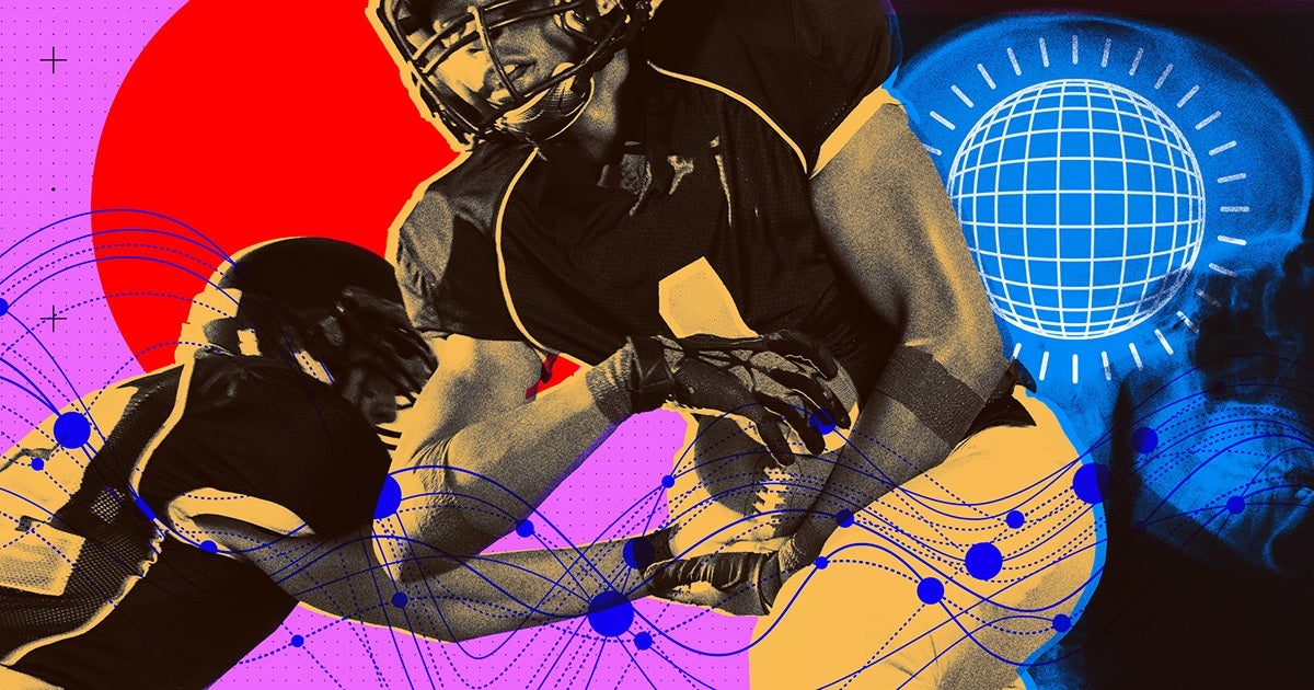 After a Single Concussion, Kids Are 15 Percent Less Likely to Go to College