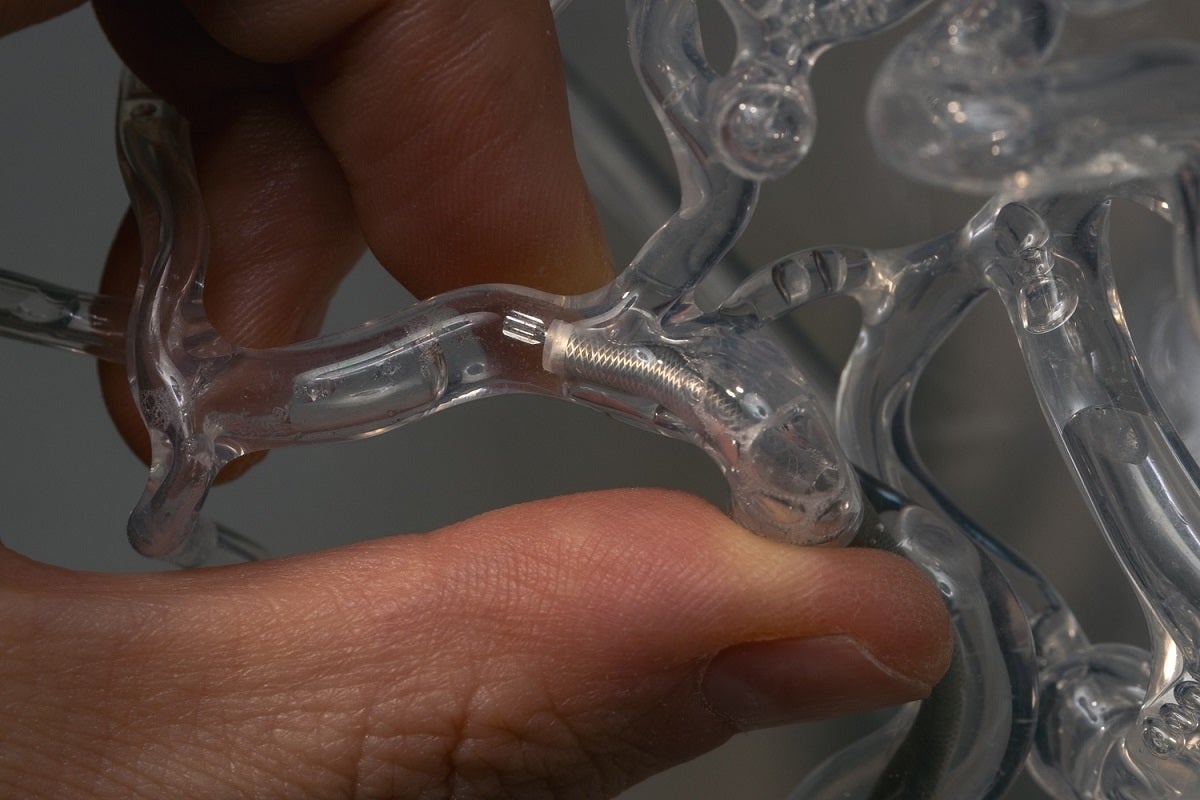 Stanford Doctors Invent Device That Appears to Be Able to Save Tons of Stroke Patients Before They Die