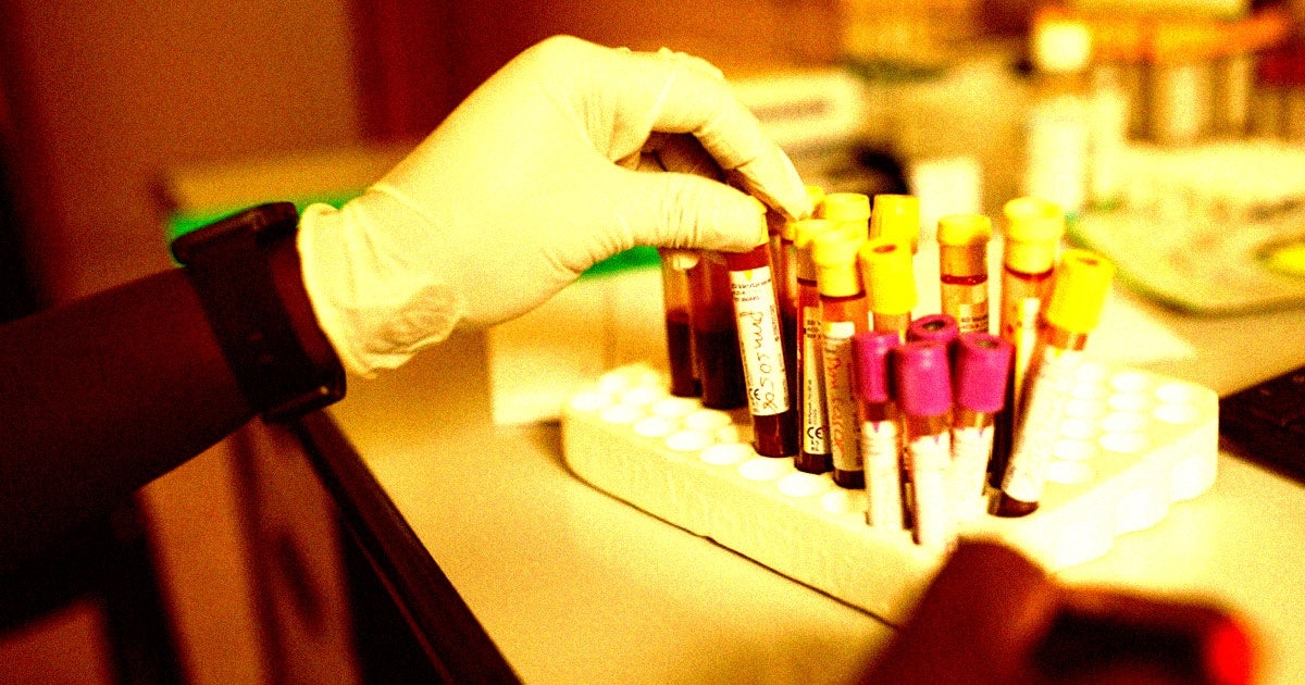 Elon Musk's Assault on the Government Has Canceled a Human Trial for a Promising HIV Vaccine