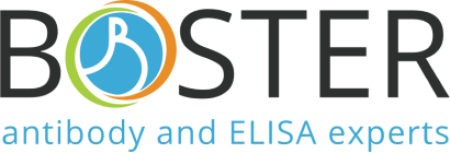 Free Antibody Validation: Boster Bio Launches New Service to Advance Research Reproducibility