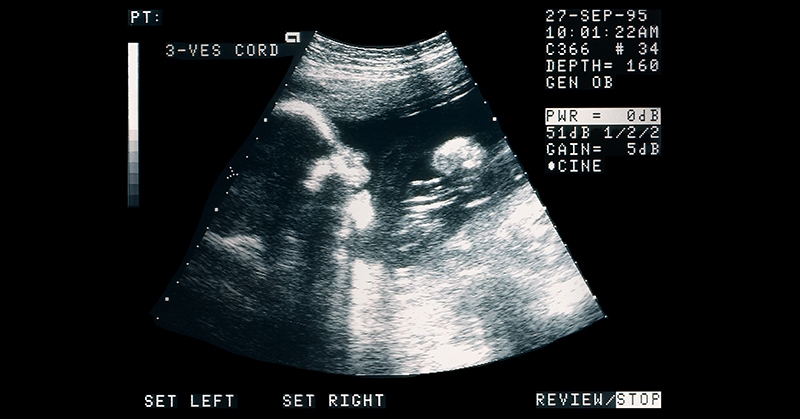 Committee advances bill adding pregnancy ultrasound video to Indiana sex ed requirements