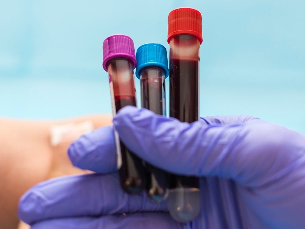 Forget 'biological age' tests — longevity experts are using an $800 under-the-radar blood test to measure aging in real-time