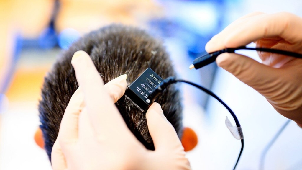AI-powered brain implant restores speech in paralysis patient after 18 years