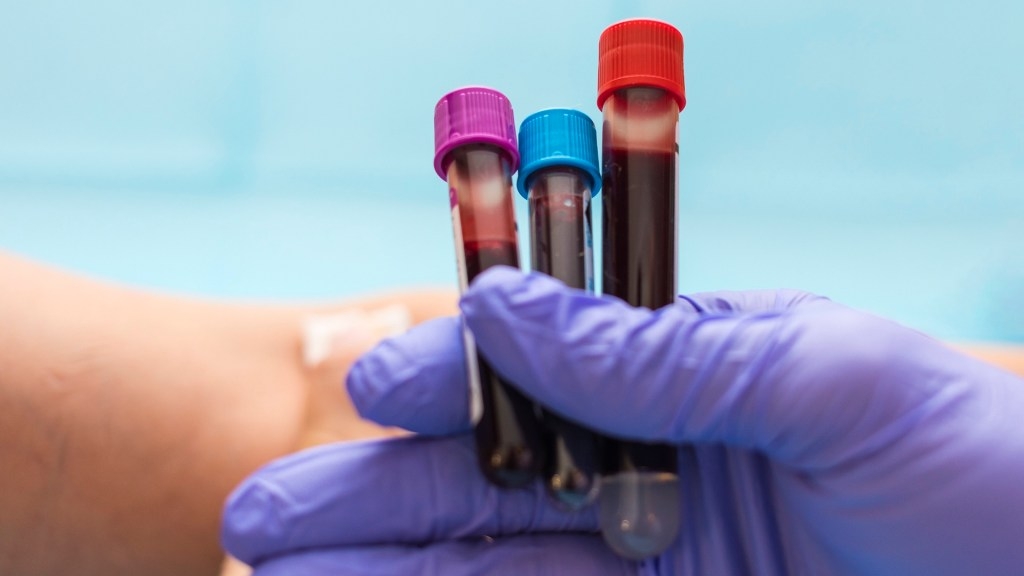 Scientists develop breakthrough blood test for rare genetic disorders in children