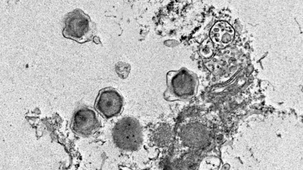 US researchers identify 230 new viruses with surprising effect on ocean health