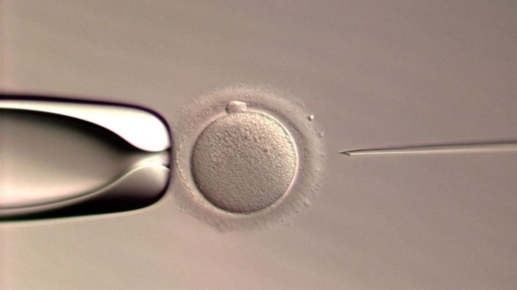Scientists announce first baby born via robotic sperm injection system