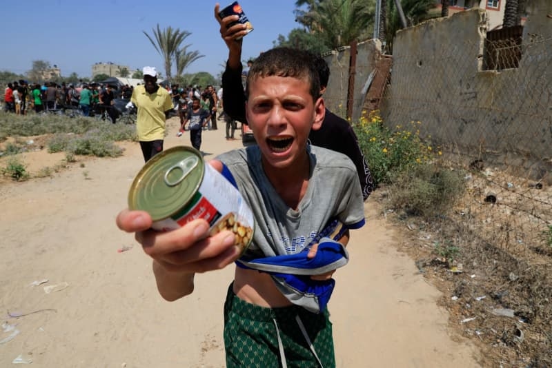 Israel slams int'l media for misrepresenting Gazan child's condition as starvation