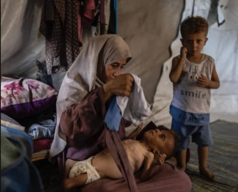 NYT quietly alters Gaza starvation story to include key details of child's medical condition