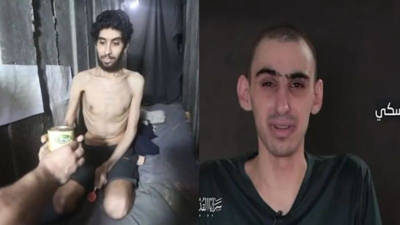 Gaza hostages Evyatar David, Rom Braslavski lost 50% of body weight, medical report says