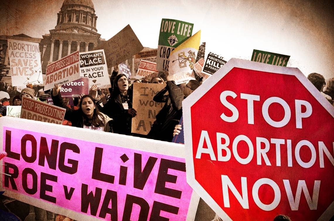 ACLU sues to block ‘misleading' abortion ban from Missouri ballot