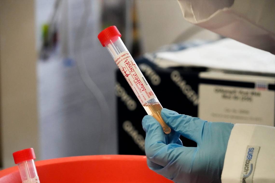 Two Kansas cats have contracted bird flu. What vets say about keeping your pets safe
