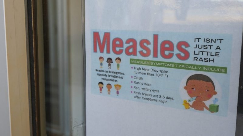 First case of measles reported in Nebraska