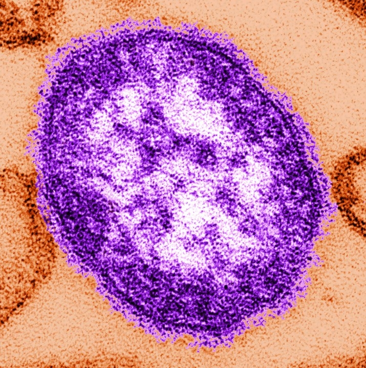 Oglala Sioux Tribe sends measles alert after case in border county