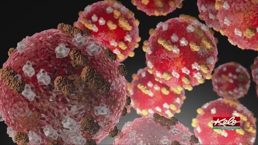 Measles inching closer to South Dakota