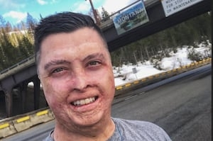 Hit and Miss with Monique Ming Laven: Daniel Lyon, Fire Survivor