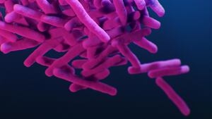 Public Health: Confirmed case of tuberculosis at Highline College