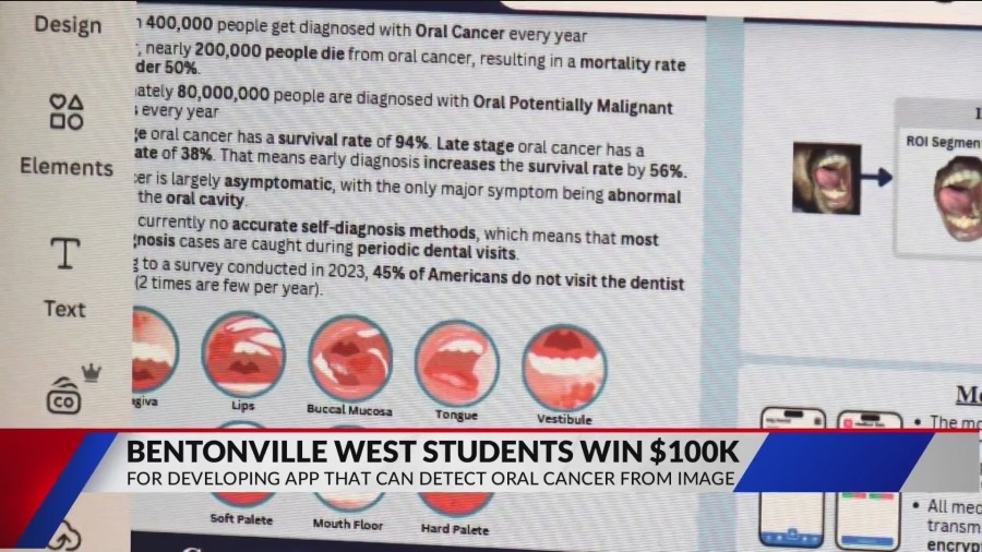 Bentonville West team wins $100K for AI-powered oral cancer detection app