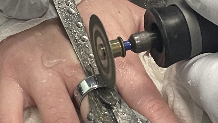 Portland firefighters called to remove titanium smart ring from woman's finger