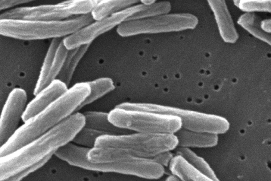 People may have been exposed to TB at these two San Diego County shelters
